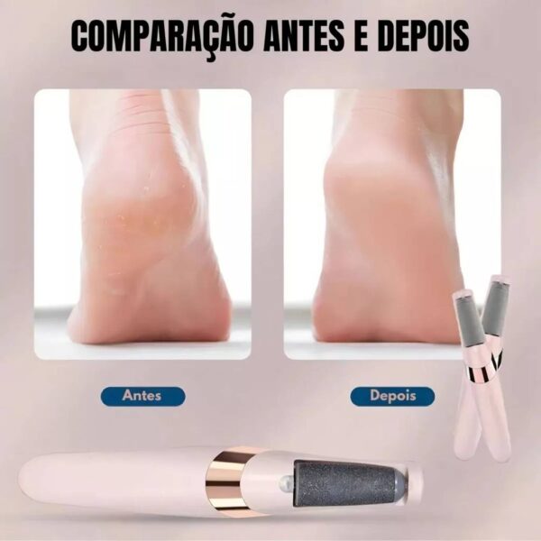 Lixador Para Pés Elétrico - Esfoliante Tira Calos Pedicure Portátil - Image 4